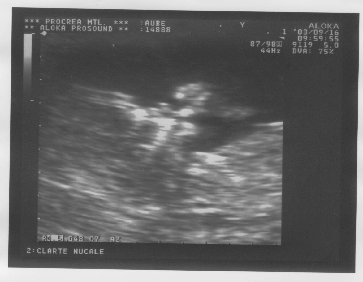 12week_ultrasound_Pic1.jpg, 16/09/2003, 75 kB