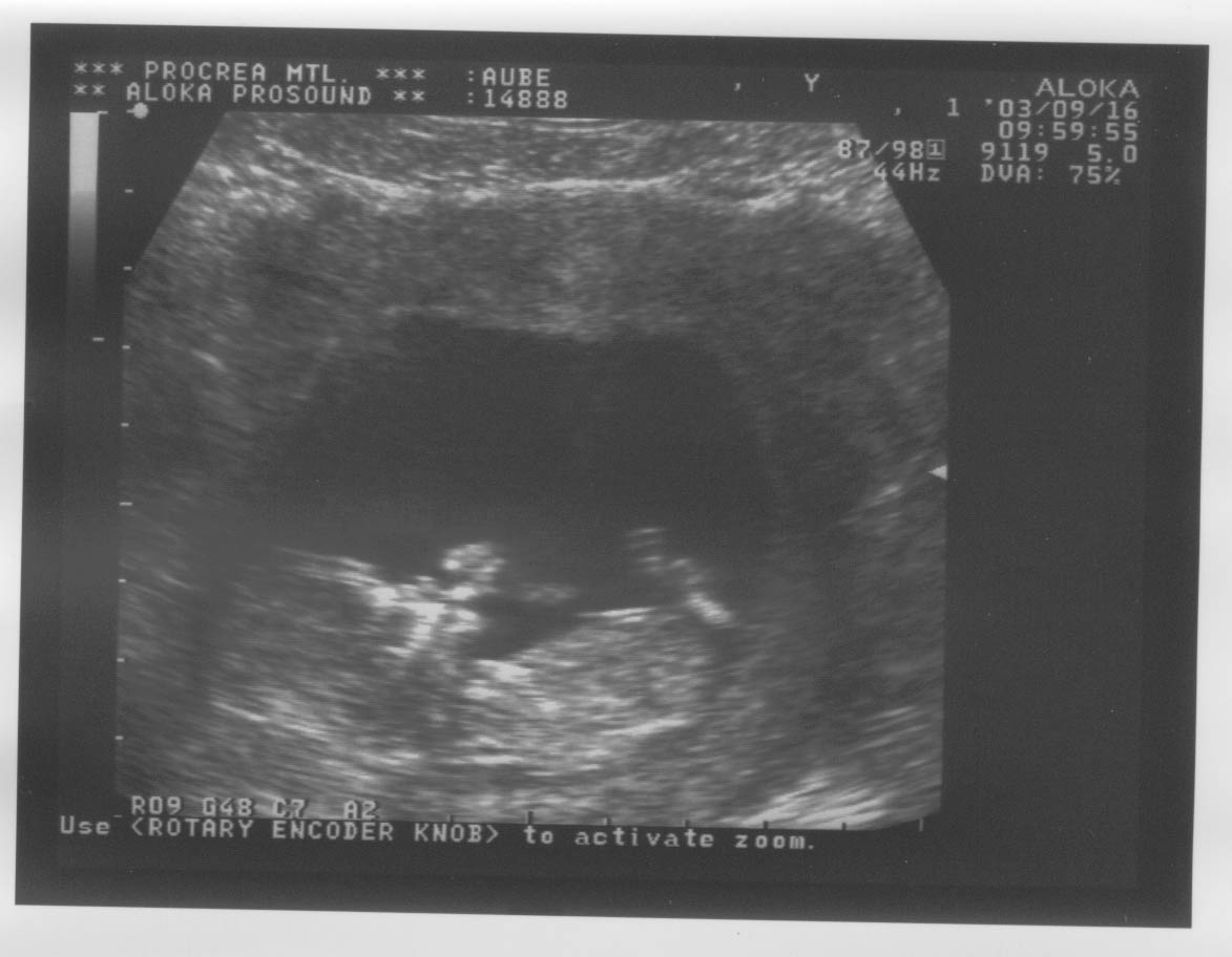 12week_ultrasound_Pic2.jpg, 16/09/2003, 83 kB