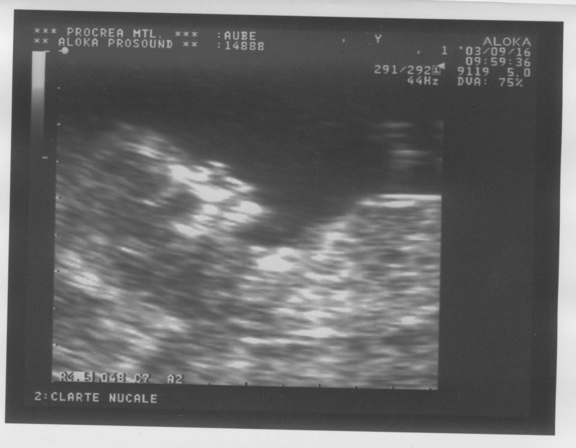 12week_ultrasound_Pic3.jpg, 16/09/2003, 79 kB