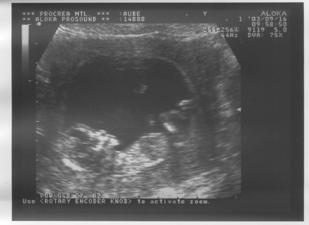 12week_ultrasound_Pic5.jpg, 16/09/2003, 84 kB